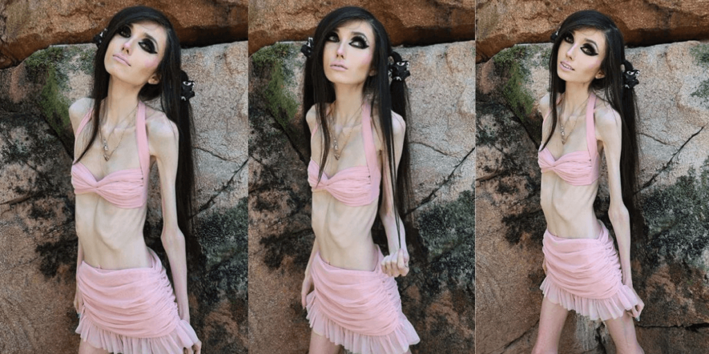 Eugenia Cooney's Eating Disorders